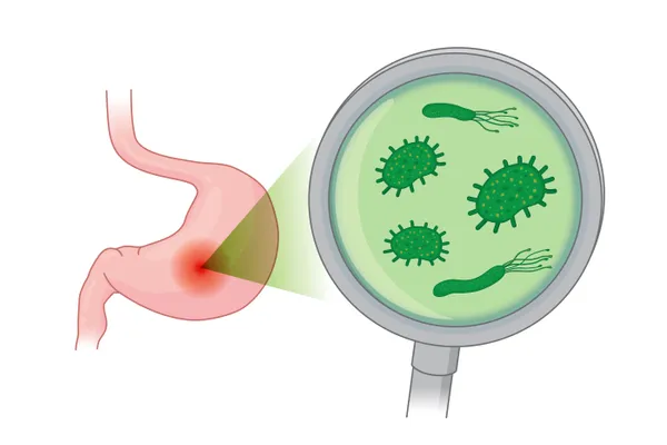 Helicobacter pylori и фукоидан